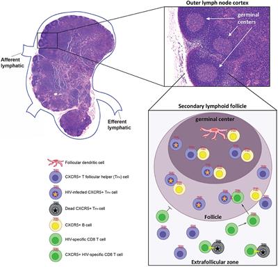 Does B Cell Follicle Exclusion of CD8+ T Cells Make Lymph Nodes Sanctuaries of HIV Replication?